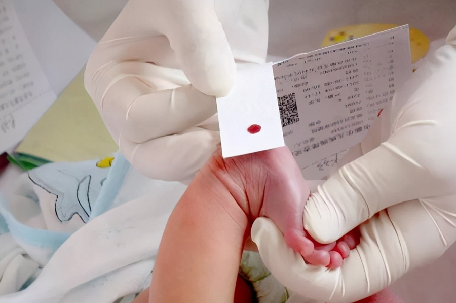 长治医院办理血缘检测需要的样本有什么,长治医院做亲子鉴定结果需要多久